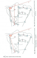 Применение компьютерных технологий для оценки состояния зубочелюстной системы - Фото 6