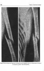 Детская травматология - Фото 6