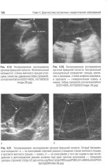 Диагностика неотложных хирургических заболеваний. Алгоритм клинического мышления - Фото 8