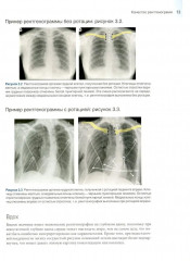Основы рентгенографии органов грудной клетки - Фото 1
