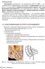 Неотложная абдоминальная хирургия - Фото 2