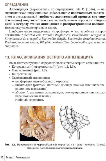 Неотложная абдоминальная хирургия