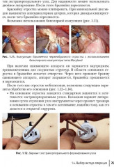 Неотложная абдоминальная хирургия - Фото 4