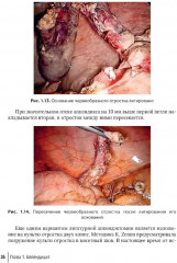 Неотложная абдоминальная хирургия - Фото 5