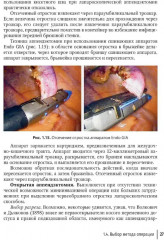 Неотложная абдоминальная хирургия - Фото 6