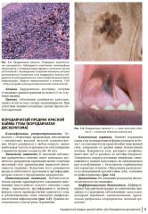 Атлас диагностики заболеваний челюстно-лицевой области - Фото 4