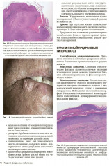 Атлас диагностики заболеваний челюстно-лицевой области - Фото 5