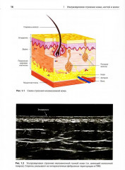 Атлас по ультразвуковому исследованию в дерматологии. Мягкие ткани, кожа, придатки кожи - Фото 2