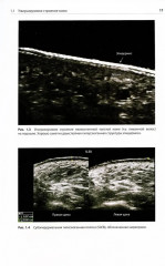 Атлас по ультразвуковому исследованию в дерматологии. Мягкие ткани, кожа, придатки кожи - Фото 3