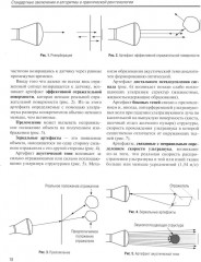 Стандартные заключения и алгоритмы в практической рентгенологии - Фото 5