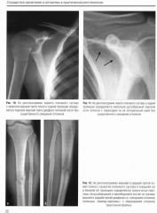 Стандартные заключения и алгоритмы в практической рентгенологии - Фото 9