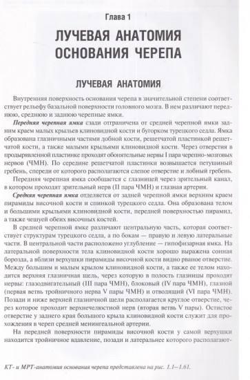 Лучевая диагностика заболеваний оснований черепа