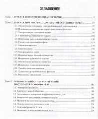Лучевая диагностика заболеваний оснований черепа и мостмозжечкового угла - Фото 3