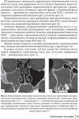 Современные аспекты диагностики и лечения одонтогенного верхнечелюстного синусита. Руководство для врачей - Фото 4