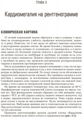 Сложные случаи в детской кардиологии - Фото 3