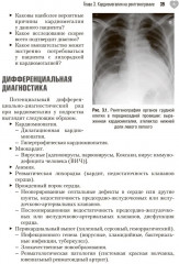 Сложные случаи в детской кардиологии - Фото 4