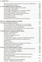 Техники эндоваскулярных манипуляций. Проводники и катетеры в эндоваскулярной хирургии - Фото 4