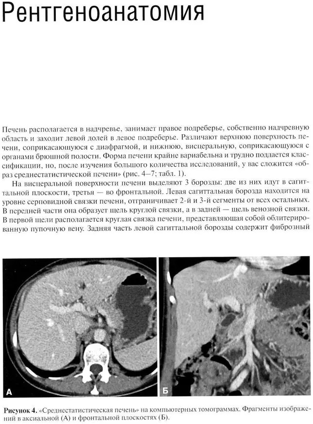 Компьютерная томография печени и желчевыводящих путей. Практическое руководство | Фото 2