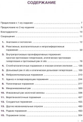 Интерпретация биопсий молочной железы - Фото 1
