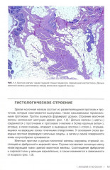 Интерпретация биопсий молочной железы - Фото 4
