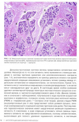 Интерпретация биопсий молочной железы - Фото 5