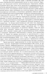 Интерпретация биопсий молочной железы - Фото 8