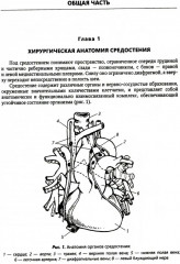 Хирургия средостения. Руководство для врачей - Фото 3