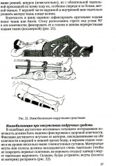 Драматические состояния в клинической практике врача - Фото 8