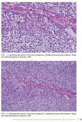 Морфологическая диагностика опухолей носа, околоносовых пазух и носоглотки. Руководство-атлас - Фото 4