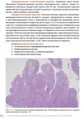 Морфологическая диагностика опухолей носа, околоносовых пазух и носоглотки. Руководство-атлас - Фото 5
