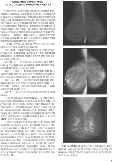 Применение международной классификации BI-RADS