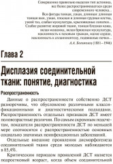 Дисплазия соединительной ткани - Фото 2
