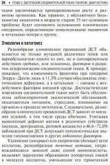 Дисплазия соединительной ткани - Фото 3