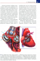 Кардиохирургия. Уровень доказательности экспертный - Фото 9