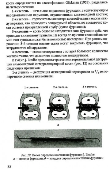 Диагностика пародонтита