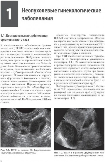 Тазовые боли у женщин. Дифференцианальная диагностика