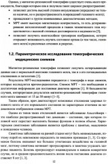 Глубокое обучение в задаче ранней диагностики деменции. Монография - Фото 6