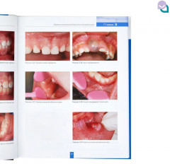 Детская стоматология - Фото 4