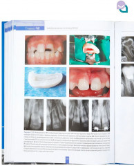 Детская стоматология - Фото 6