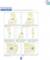 Детская стоматология - Фото 8