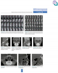 Детская стоматология - Фото 9