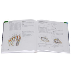 Оперативные доступы в травматологии и ортопедии - Фото 2