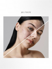 Маска для лица Saq Sub Rosa глубокоочищающая - Фото 4