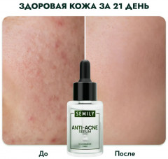 Сыворотка для лица против акне с ниацинамидом «Anti-Acne Serum» - Фото 10