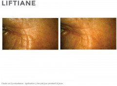 Сыворотка для лица и шеи антивозрастная - Фото 1