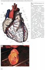 Эхокардиография в норме для начинающих - Фото 7