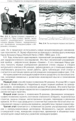 Эхокардиография в норме для начинающих - Фото 11