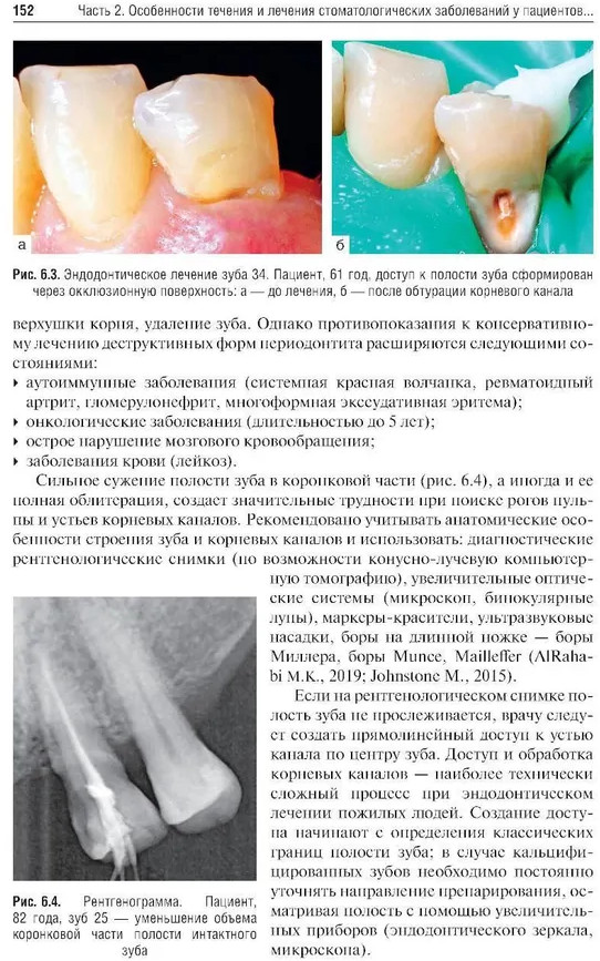 Геронтостоматология | Фото 8