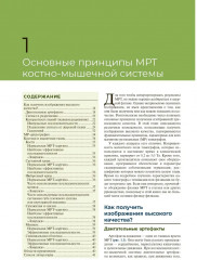 МРТ костно-мышечной системы - Фото 10