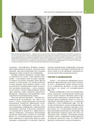 МРТ костно-мышечной системы - Фото 11
